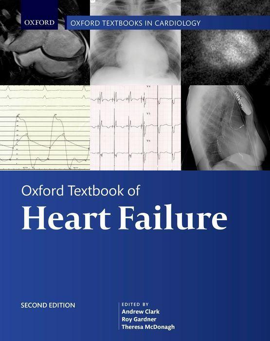 Książka Oxford Textbook of Heart Failure THERESA MCDONAGH