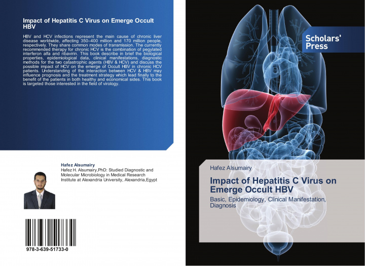 Könyv Impact of Hepatitis C Virus on Emerge Occult HBV HAFEZ ALSUMAIRY