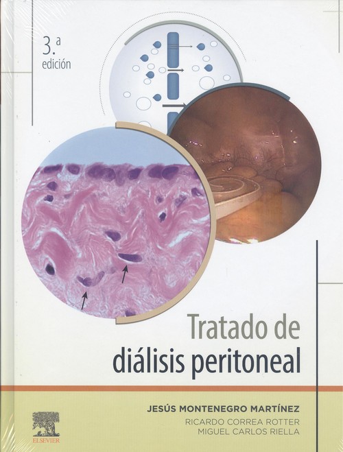 Kniha Tratado de diálisis peritoneal (3ª ed.) JESUS MONTENEGRO MARTINEZ
