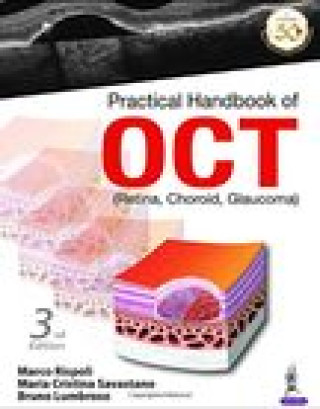 Книга Practical Handbook of OCT Marco Rispoli