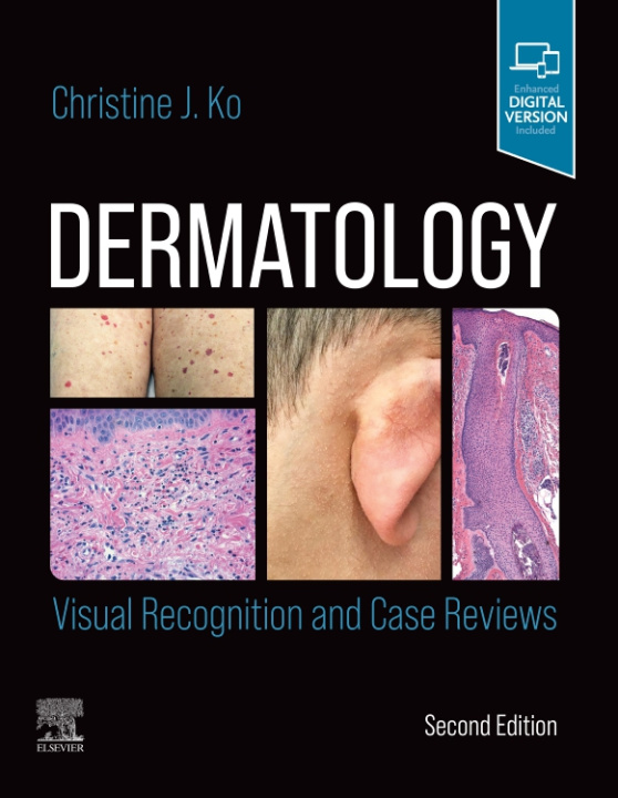 Książka Dermatology: Visual Recognition and Case Reviews Christine J. Ko