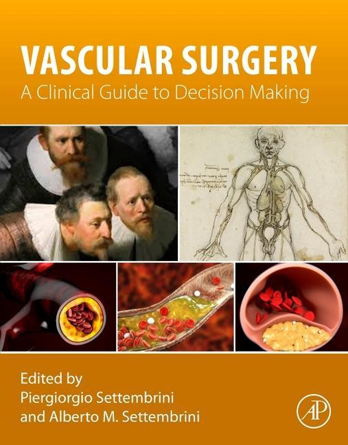 Carte Vascular Surgery Piergiorgio Settembrini
