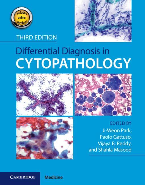 Carte Differential Diagnosis in Cytopathology 