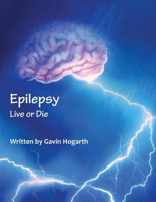 Carte Epilepsy Gavin Hogarth