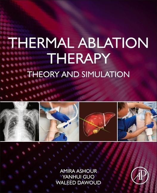 Книга Thermal Ablation Therapy Amira S. Ashour