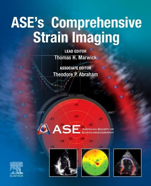 Carte ASE's Comprehensive Strain Imaging Thomas H. Marwick