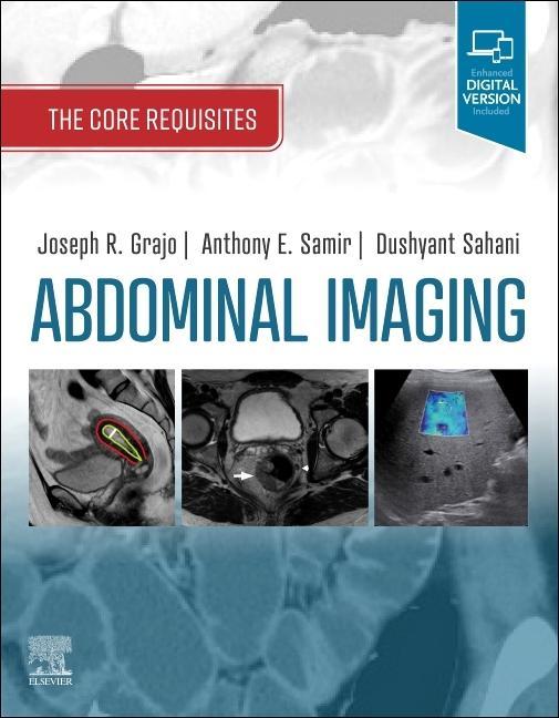 Książka Abdominal Imaging Joseph R. Grajo