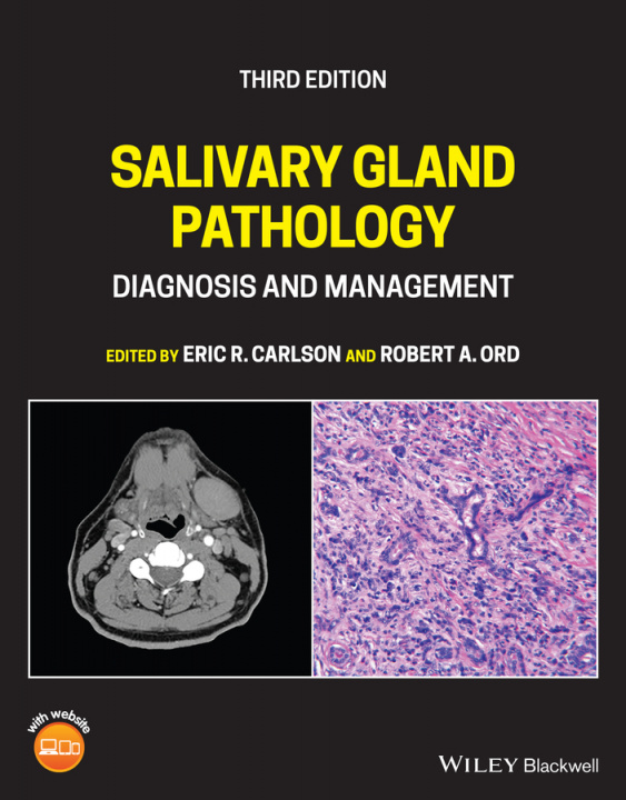 Książka Salivary Gland Pathology - Diagnosis and Management Third Edition 