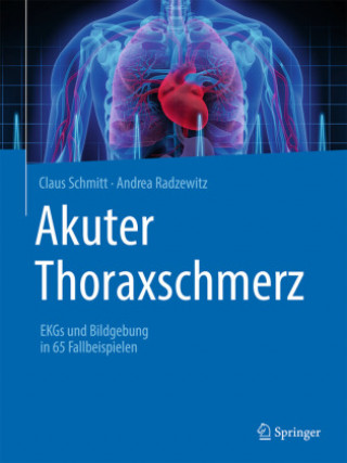 Carte Akuter Thoraxschmerz Andrea Radzewitz