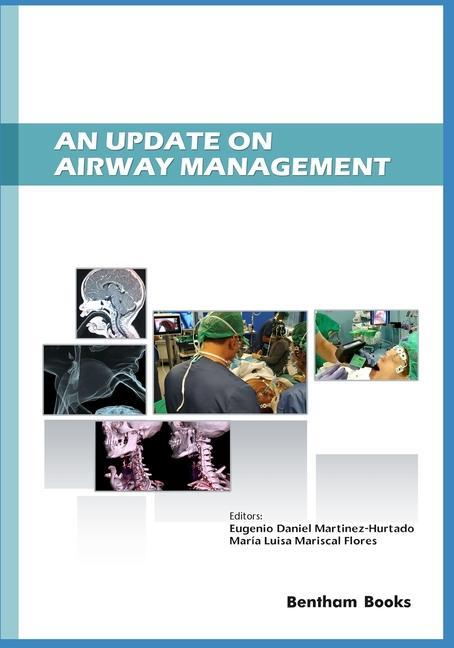 E-knjiga Update on Airway Management Eugenio Daniel Martinez-Hurtado