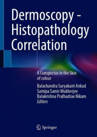 Kniha Dermoscopy - Histopathology Correlation Samipa Samir Mukherjee