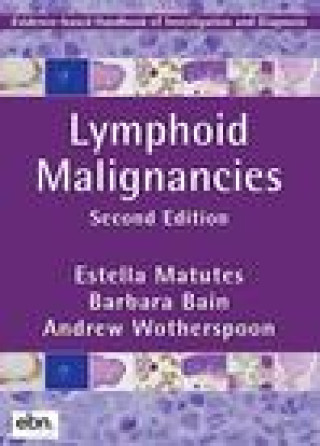 Knjiga Lymphoid Malignancies Estella Matutes