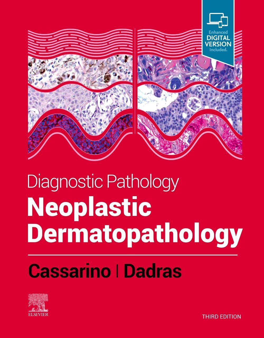 Książka Diagnostic Pathology: Neoplastic Dermatopathology David S. Cassarino