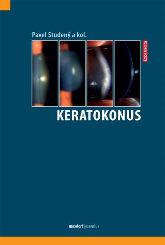Kniha Keratokonus Pavel Studený a kolektiv