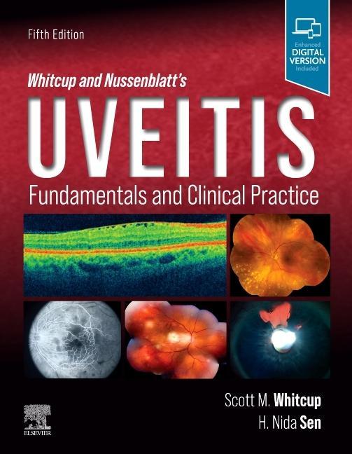 Carte Whitcup and Nussenblatt's Uveitis Scott M. Whitcup
