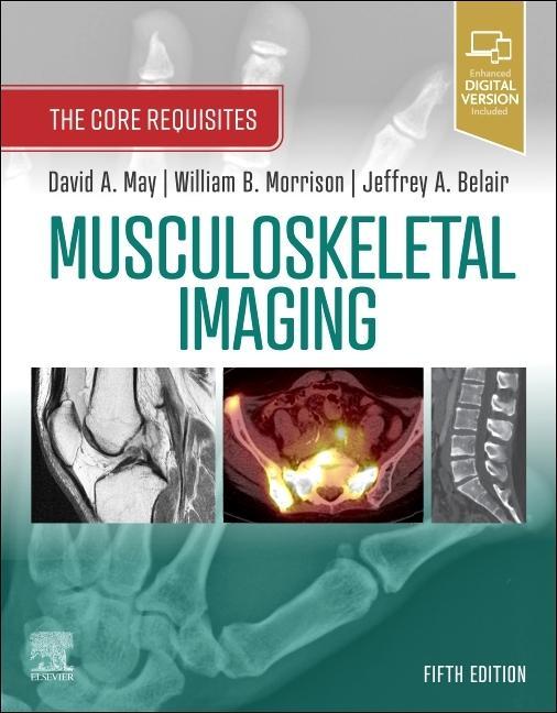 Kniha Musculoskeletal Imaging David A. May