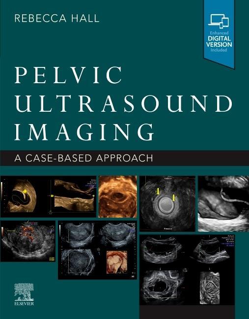 Knjiga Pelvic Ultrasound Imaging Rebecca Hall