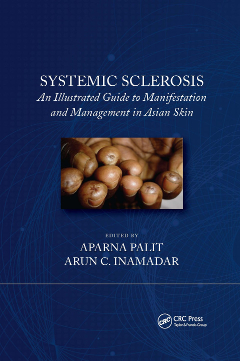 Knjiga Systemic Sclerosis Arun C. Inamadar