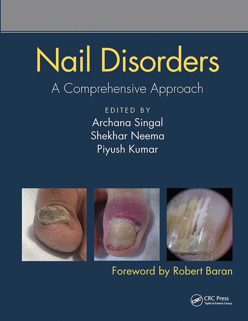 Carte Nail Disorders 