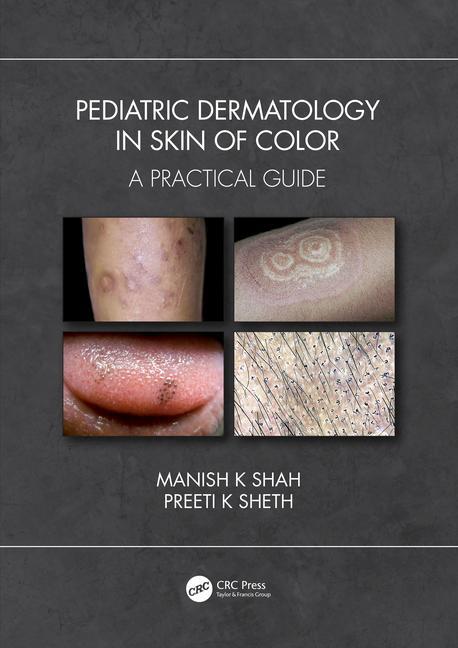 Книга Pediatric Dermatology in Skin of Color Shah