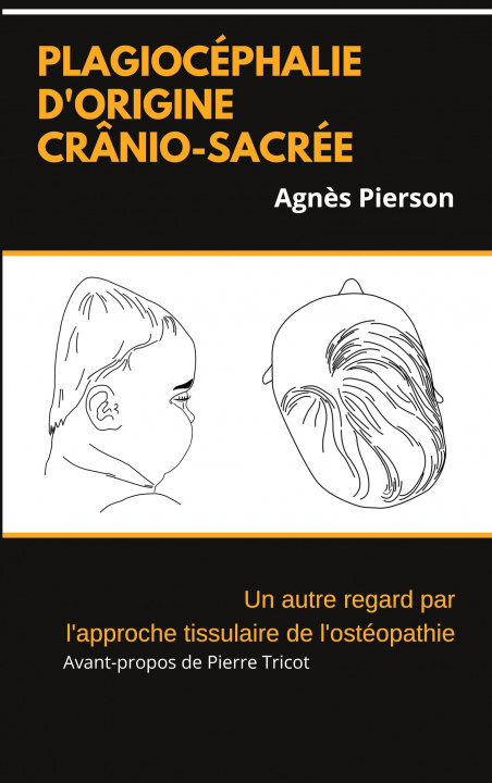 Kniha plagiocephalie d'origine cranio-sacree 