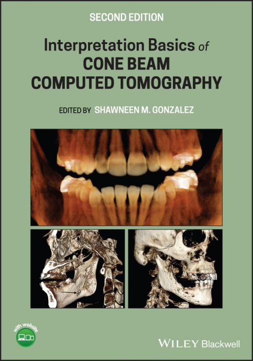 Книга Interpretation Basics of Cone Beam Computed Tomography 