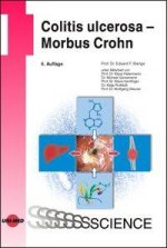 Könyv Colitis ulcerosa - Morbus Crohn 