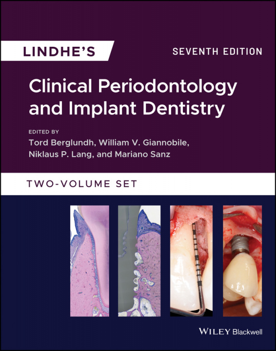 Carte Lindhe's Clinical Periodontology and Implant Dentistry 7e 