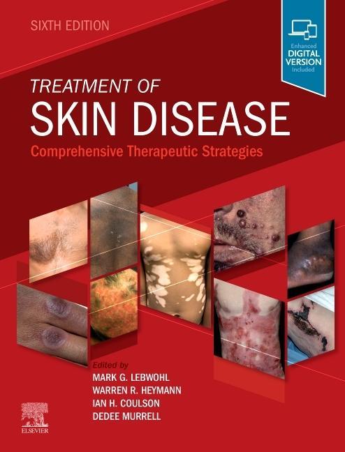 Книга Treatment of Skin Disease Mark G. Lebwohl