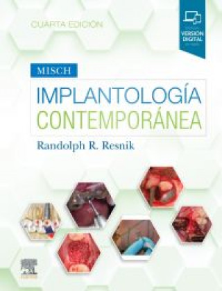 Kniha Misch. Implantología contemporánea, 4.ª Edición RANDOLPH R. RESNIK