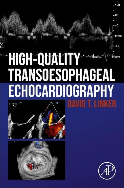 Kniha High-Quality Transesophageal Echocardiography 