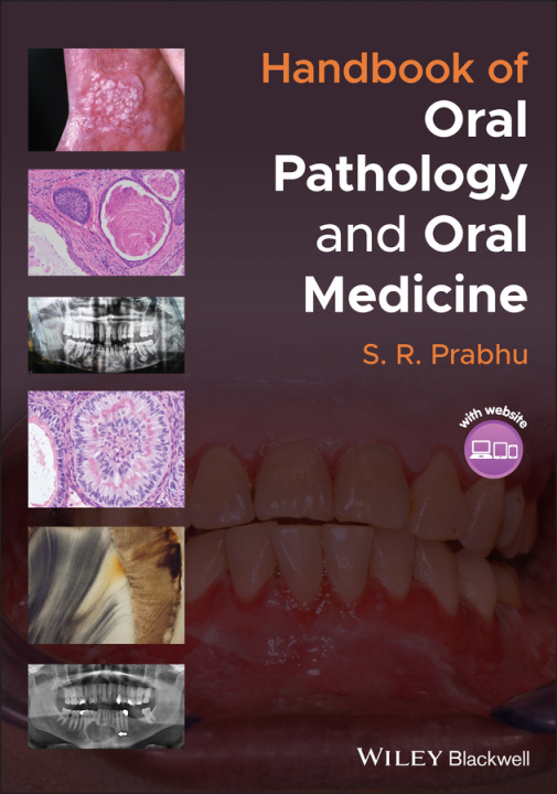 Carte Handbook of Oral Pathology and Oral Medicine S. R. Prabhu