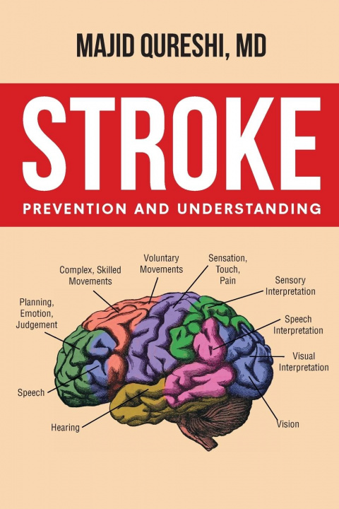 Knjiga Stroke Majid Qureshi