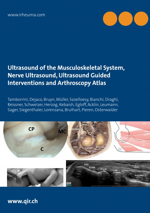 Kniha Ultrasound of the Musculoskeletal System, Nerve Ultrasound, Ultrasound Guided Interventions and Arthroscopy Atlas Christian Dejaco George A. W. Bruyn