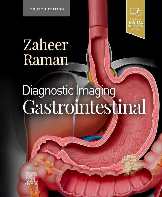 Kniha Diagnostic Imaging: Gastrointestinal Atif Zaheer