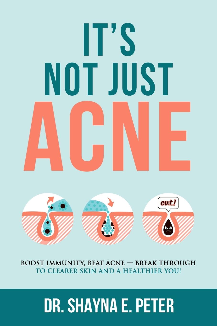 Книга It's Not Just Acne 