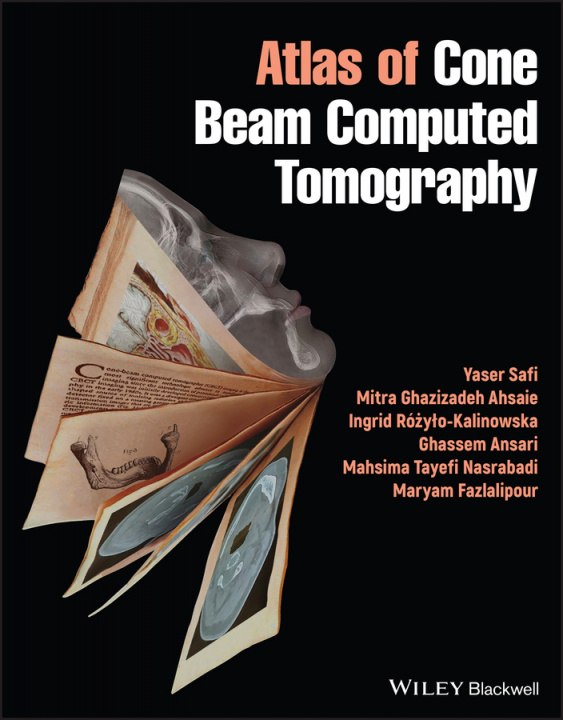 Книга Atlas of Cone Beam Computed Tomography Yaser Safi