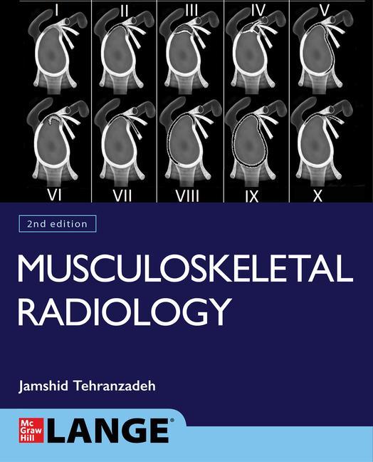 Carte Basic Musculoskeletal Imaging, Second Edition 