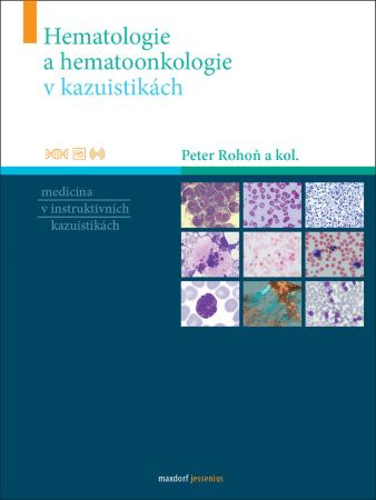 Kniha Hematologie a hematoonkologie v kazuistikách Peter Rohoň a kolektiv