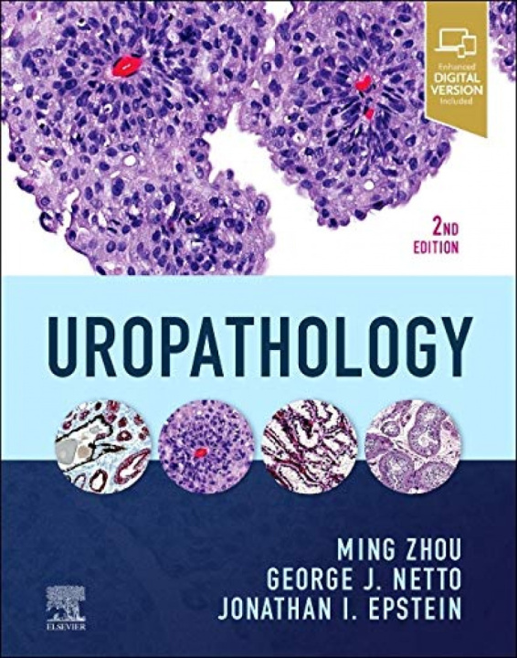 Buch Uropathology Ming Zhou