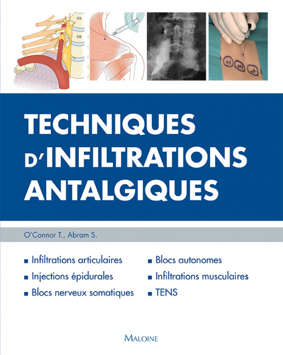 Kniha TECHNIQUES D'INFILTRATIONS ANTALGIQUES O'Connor