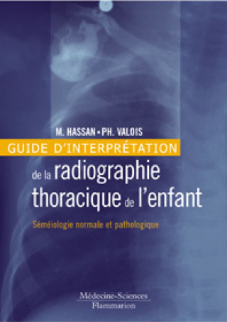 Kniha Guide d'interprétation de la radiographie thoracique de l'enfant - séméiologie normale et pathologique Hassan
