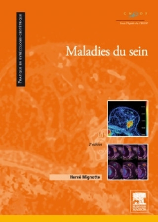 Knjiga Maladies du sein Hervé Mignotte