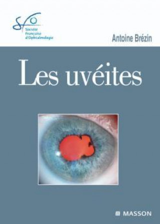 Книга Les uvéites Antoine Brézin