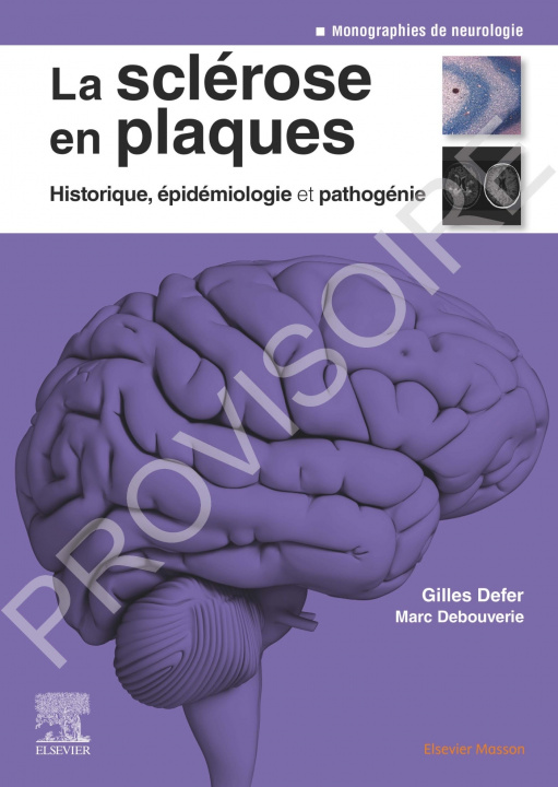 Carte La sclérose en plaques - Historique, épidémiologie et pathogénie Gilles Defer