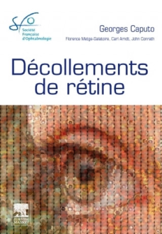 Kniha Décollements de rétine Georges Caputo