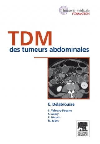 Kniha TDM des tumeurs abdominales Professeur Eric Delabrousse