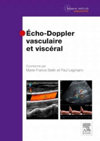 Könyv Echo-Doppler vasculaire et viscéral Marie-France Bellin