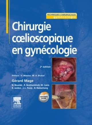 Kniha Chirurgie coelioscopique en gynécologie Gérard Mage