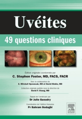 Kniha Uvéites : 49 questions cliniques C. Stephen Foster